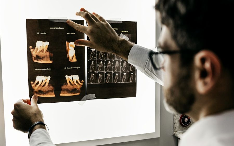 Dentista analisando tomografia 3D para planejar um implante